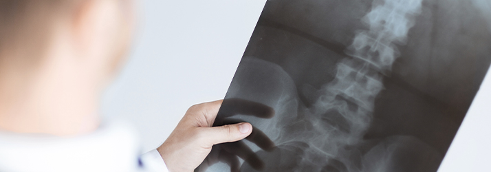 Chiropractic Fargo ND X-Ray Chiropractic Fargo ND X-Ray